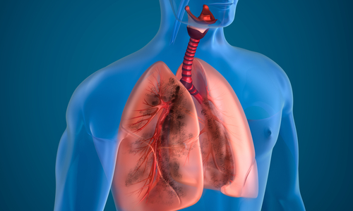 ശ്വാസകോശ രോഗങ്ങളും അടിയന്തര ചികിത്സകളും 