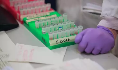 കോവിഡ് 19: ഇറ്റലിയില്‍ ഇന്നലെ മാത്രം മരിച്ചത് 475 പേര്‍