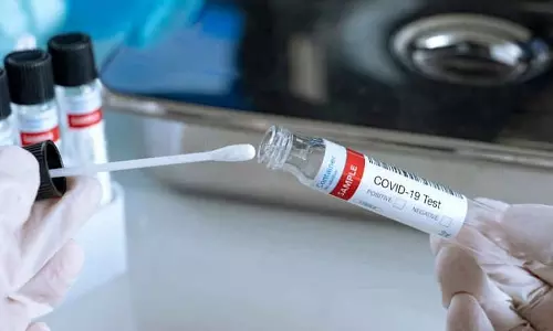 ബഹ്​റൈനിൽ 605 പേർക്ക് ഞായറാഴ്ച കോവിഡ്​ സ്ഥിരീകരിച്ചു  