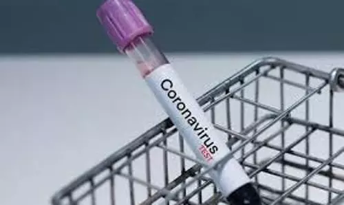 ലോകത്ത് കോവിഡ് ബാധിതരുടെ എണ്ണം ഒരു കോടി കവിഞ്ഞു; മരണം അഞ്ച് ലക്ഷവും കടന്നു