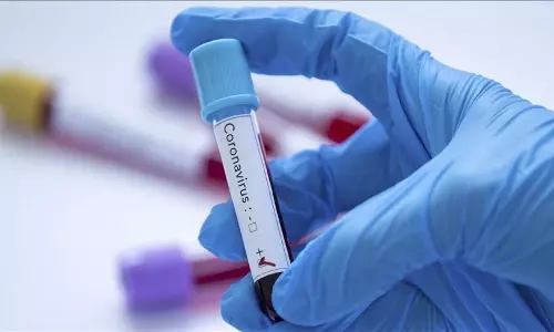 കുവൈത്തിൽ 161 പേർക്ക് കൂടി കോവിഡ്; രോഗികളുടെ എണ്ണം  1000 കടന്നു 