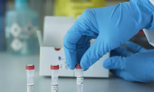 ബഹ്​റൈനിൽ ഇത് വരെ കോവിഡ്​ സ്​ഥിരീകരിച്ചത്​ 1909 പ്രവാസികൾക്ക്