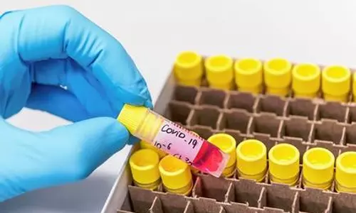 എറണാകുളത്ത് ആരോഗ്യപ്രവര്‍ത്തകന് കോവിഡ് ബാധിച്ചത് പ്രതിരോധ പ്രവര്‍ത്തനങ്ങള്‍ക്കിടെ; ആരോഗ്യനില തൃപ്തികരം 