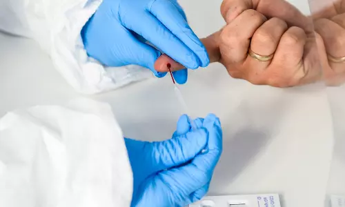 കോവിഡും ഇമ്മ്യൂണിറ്റിയും തട്ടിപ്പുചികിത്സകളും