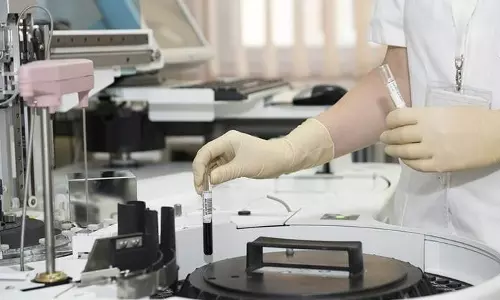 കോവിഡ് പരിശോധനയ്ക്കായി ഗുജറാത്തിലെ പ്രത്യേക കമ്പനിയുടെ മാത്രം കിറ്റ്: ദുരൂഹമായ നീക്കവുമായി കേന്ദ്രം