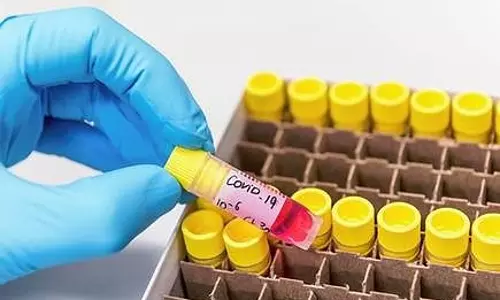 കോവിഡ് :ബഹ്റൈനിൽ ഒരാൾ കൂടി മരിച്ചു   