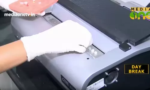 അരമണിക്കൂറിനുള്ളില്‍ ടി.ബി കണ്ടെത്താം; നേട്ടവുമായി ശ്രീചിത്ര ഇന്‍സ്റ്റിറ്റ്യൂട്ട്