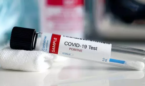 പരിശോധനഫലം 50 മിനിറ്റിനുള്ളില്‍; പോര്‍ട്ടബിള്‍ കോവിഡ് ടെസ്റ്റുമായി യു.കെയിലെ ഗവേഷകര്‍