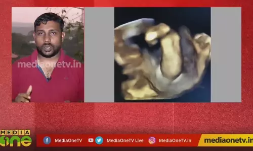 ഒരു കുഞ്ഞിനുള്ളിൽ മറ്റൊരു കുഞ്ഞ് 