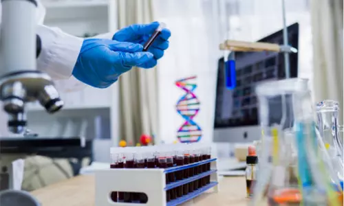 കരുതിയതു പോലെയല്ല, കൊറോണയുടെ വ്യാപനം ഇരട്ടി വേഗത്തിലെന്ന് പഠനം കരുതിയതു പോലെയല്ല, കൊറോണയുടെ വ്യാപനം ഇരട്ടി വേഗത്തിലെന്ന് പഠനം