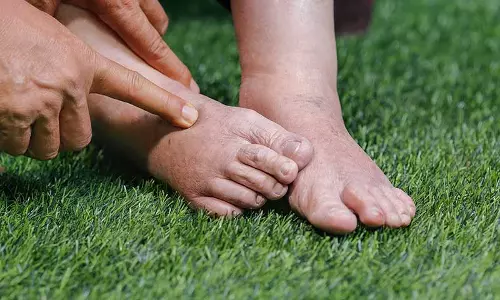 മുഖത്തും കാല്‍പ്പാദങ്ങളിലും നീരുണ്ടോ? മൂത്രമൊഴിക്കുമ്പോൾ അസ്വസ്ഥതയുണ്ടോ? വൃക്ക രോഗത്തിന്‍റെ ലക്ഷണങ്ങളാകാം