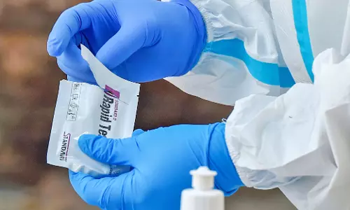 സംസ്ഥാനത്ത് ഇന്ന് 5214 പേര്‍ക്ക് കോവിഡ് സ്ഥിരീകരിച്ചു