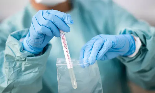 ജനസംഖ്യയുടെ നാല്പത് ശതമാനത്തിലധികം പേർക്ക് കോവിഡ് ടെസ്റ്റുകൾ നടത്തുന്ന രാജ്യമായി ബഹ്റൈന്‍