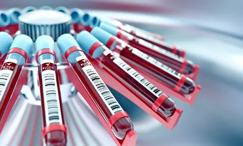 രക്തത്തിലെ മദ്യത്തിന്റെ അളവ്  മരുന്നു കഴിച്ച് കുറയ്ക്കാൻ പറ്റുമോ?