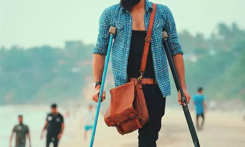 അപകടത്തെ തുടര്‍ന്ന് ഒരു കാല്‍ മുറിച്ചു മാറ്റിയിട്ടും മോഡലിംഗ് രംഗത്ത് തിളങ്ങി തസ്‍വീര്‍ മുഹമ്മദ്