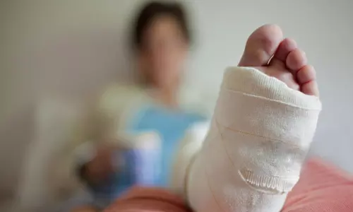 അപകടത്തിൽ പരിക്ക്: ഇൻഷുറൻസ് കമ്പനി നൽകിയത് 3.4 ലക്ഷം, 21 ലക്ഷം കൂടി അധികം നൽകണമെന്ന് സുപ്രീം കോടതി