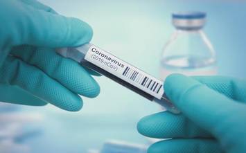 സംസ്ഥാനത്ത് ഇന്ന് 1412 പേര്‍ക്ക് കോവിഡ് സ്ഥിരീകരിച്ചു