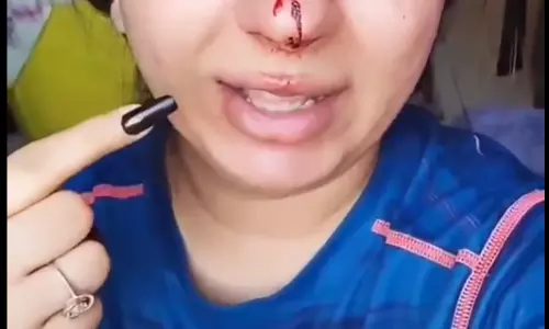 ഉപഭോക്താവിന്‍റെ മുഖത്തടിച്ചെന്ന് പരാതി; ഡെലിവറി ജീവനക്കാരനെ പുറത്താക്കി സൊമാറ്റോ