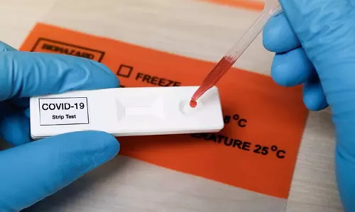 സംസ്ഥാനത്ത് ഇന്ന് 3254 പേര്‍ക്ക് കോവിഡ് സ്ഥിരീകരിച്ചു