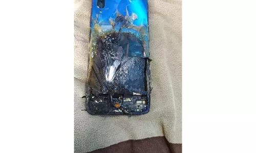 ഷവോമി ഫോണ്‍ തീപിടിച്ചു, കുറ്റം ഉടമയുടേതെന്ന് കമ്പനി