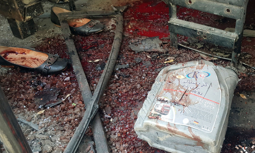 കാബൂളില്‍ വിവിധ സമയങ്ങളിലായി മൂന്ന് സ്ഫോടനം;  2 പേര്‍ കൊല്ലപ്പെട്ടു, നിരവധി പേര്‍ക്ക് പരിക്ക്