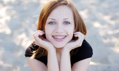 നിങ്ങളുടെ പല്ലുകള്‍ക്ക് കമ്പിയിട്ടിട്ടുണ്ടോ? എങ്കില്‍ ഇക്കാര്യങ്ങള്‍ ശ്രദ്ധിക്കൂ