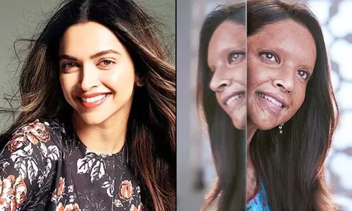 വീണ്ടും വിസ്മയിപ്പിച്ച് ദീപിക; ഛപാകിന്റെ ട്രെയിലര്‍ എത്തി