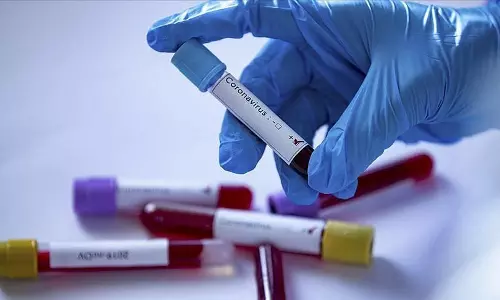 സംസ്ഥാനത്ത് ഇന്ന് 2078 പേര്‍ക്ക് കോവിഡ് സ്ഥിരീകരിച്ചു