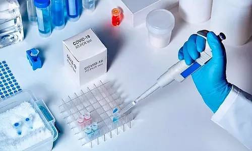 ബഹ്റൈനിൽ കോവിഡ് പ്രതിരോധത്തിന് നിര്ദേശിച്ച കാര്യങ്ങൾ പാലിക്കുന്നതില് അതീവ ശ്രദ്ധ തുടരണമെന്ന് അധിക്യതർ ബഹ്റൈനിൽ കോവിഡ് പ്രതിരോധത്തിന് നിര്ദേശിച്ച കാര്യങ്ങൾ പാലിക്കുന്നതില് അതീവ ശ്രദ്ധ തുടരണമെന്ന് അധിക്യതർ