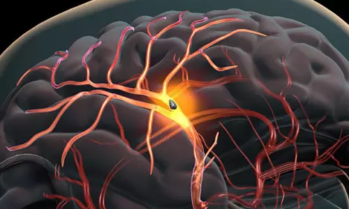 സ്‌ട്രോക്കിനെ അറിയൂ, ജീവനും ജീവിതവും രക്ഷിക്കൂ