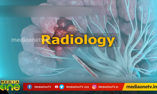 റേഡിയോളജി|Stethoscope റേഡിയോളജി|Stethoscope