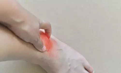 യൂറിക് ആസിഡും മലയാളിയുടെ ഭക്ഷണരീതിയും