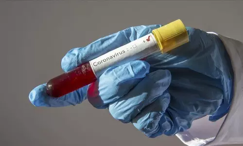 ഖത്തറില്‍ കോവിഡ് ബാധിച്ച 262 പേരില്‍ 250 പേരും വിദേശികള്‍