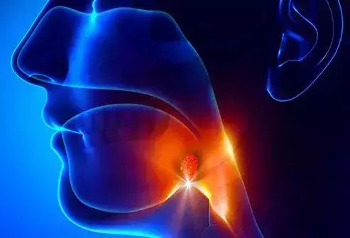 പകരുന്ന അസുഖമാണ് ടോണ്‍സിലൈറ്റിസ്