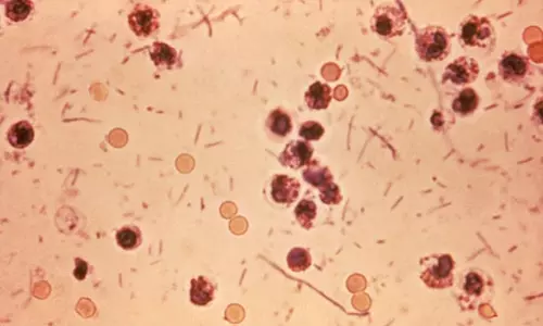 വയനാട്ടിൽ ഷിഗല്ല ബാധിച്ച് രണ്ട് പേർ മരിച്ചു