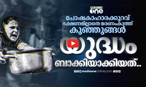 ഗസ്സയിലെ കുട്ടികളില്‍ മരണത്തിന് പോലും കാരണമായേക്കാവുന്ന പോഷകാഹാര പ്രശ്‌നങ്ങള്‍ | Gaza