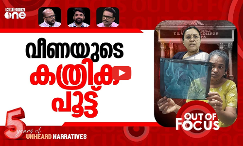 വയറ്റിലെ കത്രികകള്‍ | Scissors left in womans abdomen after surgery | Out Of Focus