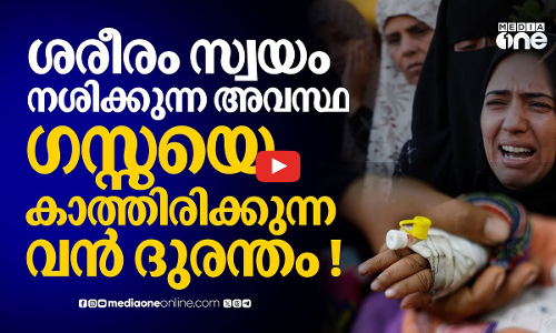 വിശപ്പ് മരണമാകുന്ന ദുരവസ്ഥ; ഗസ്സയിൽ പട്ടിണിമരണങ്ങൾ ഉണ്ടാകുന്നത് ഇങ്ങനെ! | Gaza Starvation
