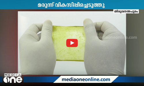 ആഴത്തിലുള്ള മുറിവുകൾ ഇനി പെട്ടെന്ന് ഉണങ്ങും; മരുന്ന് വികസിപ്പിച്ച് ശ്രീചിത്ര ഇൻസ്റ്റിറ്റ്യൂട്ട്
