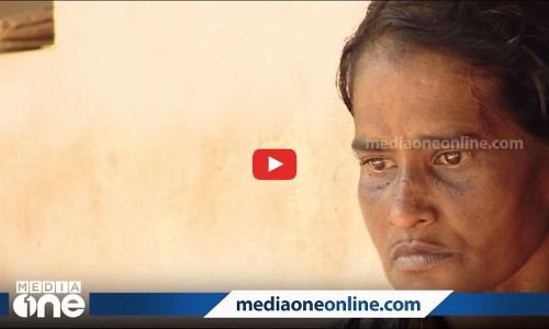 ഇരുവൃക്കകളും തകരാറില്‍, ഡയാലിസിസിന് പോലും പണമില്ല... ദുരിത ജീവിതം